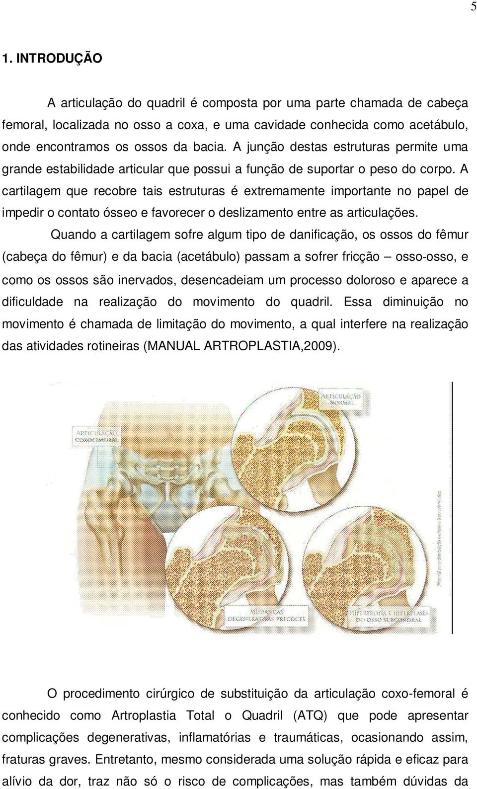 A cartilagem que recobre tais estruturas é extremamente importante no papel de impedir o contato ósseo e favorecer o deslizamento entre as articulações.