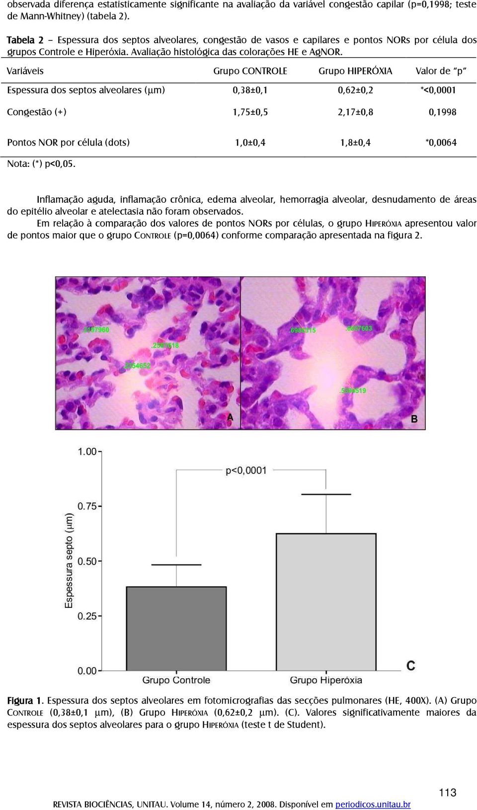 Variáveis Grupo CONTROLE Grupo HIPERÓXIA Valor de p Espessura dos septos alveolares (µm) 0,38±0,1 0,62±0,2 *<0,0001 Congestão (+) 1,75±0,5 2,17±0,8 0,1998 Pontos NOR por célula (dots) 1,0±0,4 1,8±0,4