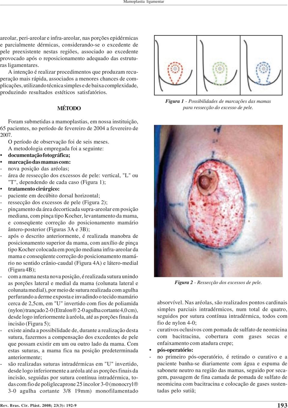 excedente provocado após o reposicionamento adequado das estruturas ligamentares.