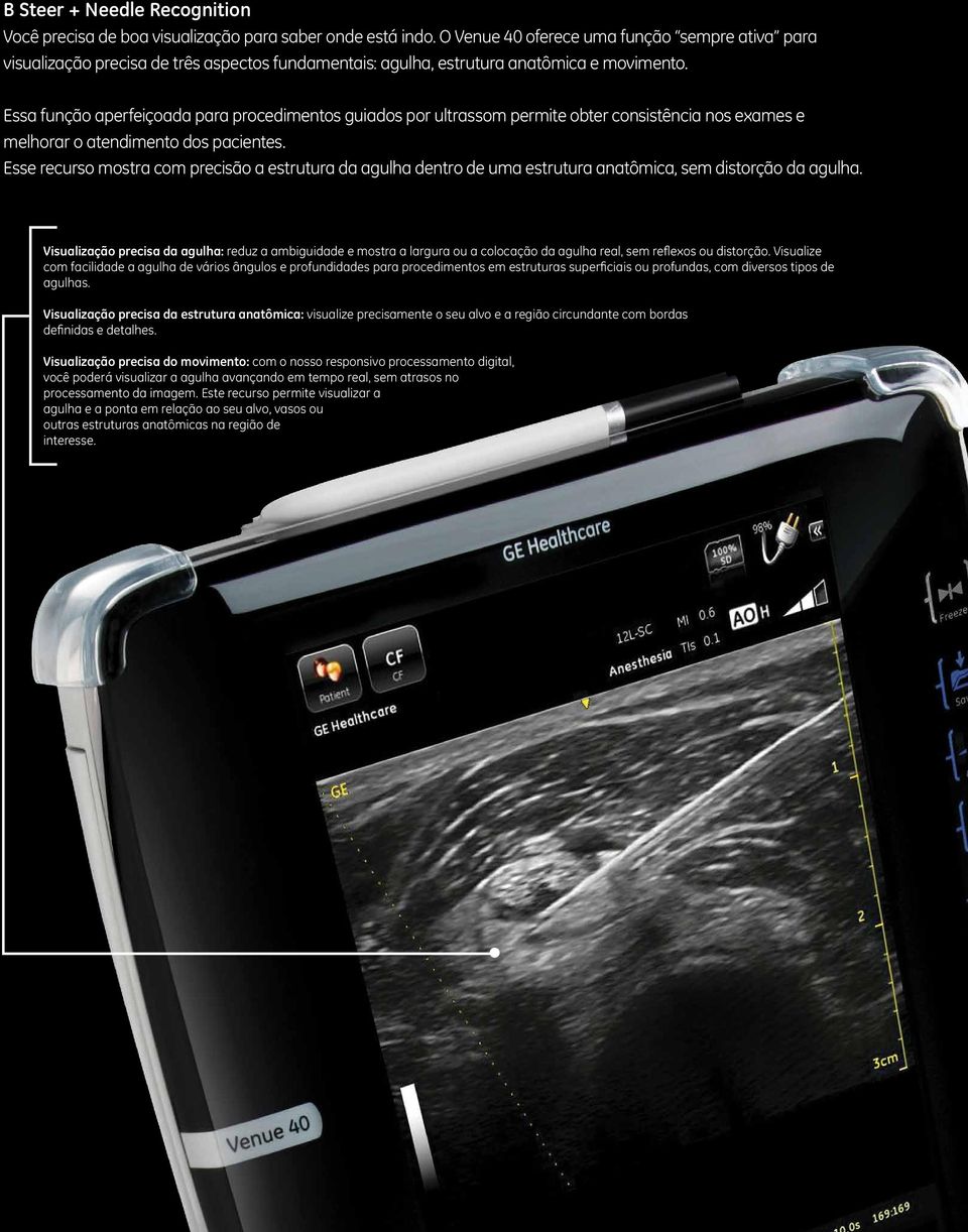 Essa função aperfeiçoada para procedimentos guiados por ultrassom permite obter consistência nos exames e melhorar o atendimento dos pacientes.