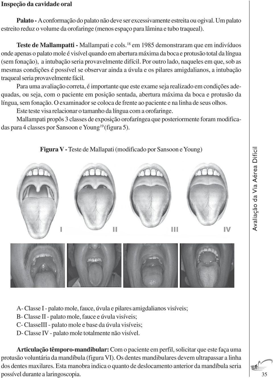 18 em 1985 demonstraram que em indivíduos onde apenas o palato mole é visível quando em abertura máxima da boca e protusão total da língua (sem fonação), a intubação seria provavelmente difícil.