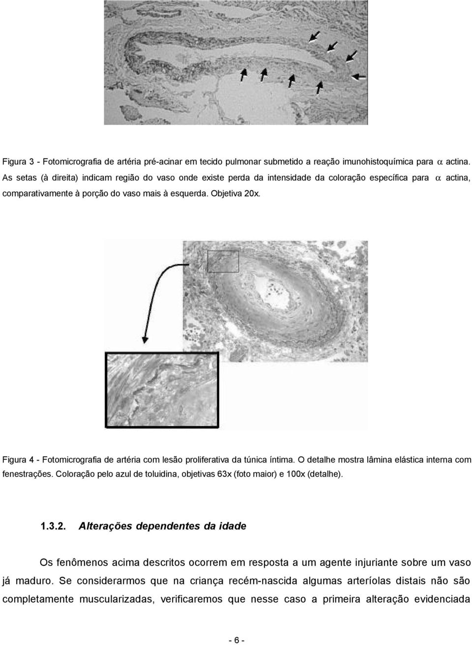 Figura 4 - Fotomicrografia de artéria com lesão proliferativa da túnica íntima. O detalhe mostra lâmina elástica interna com fenestrações.