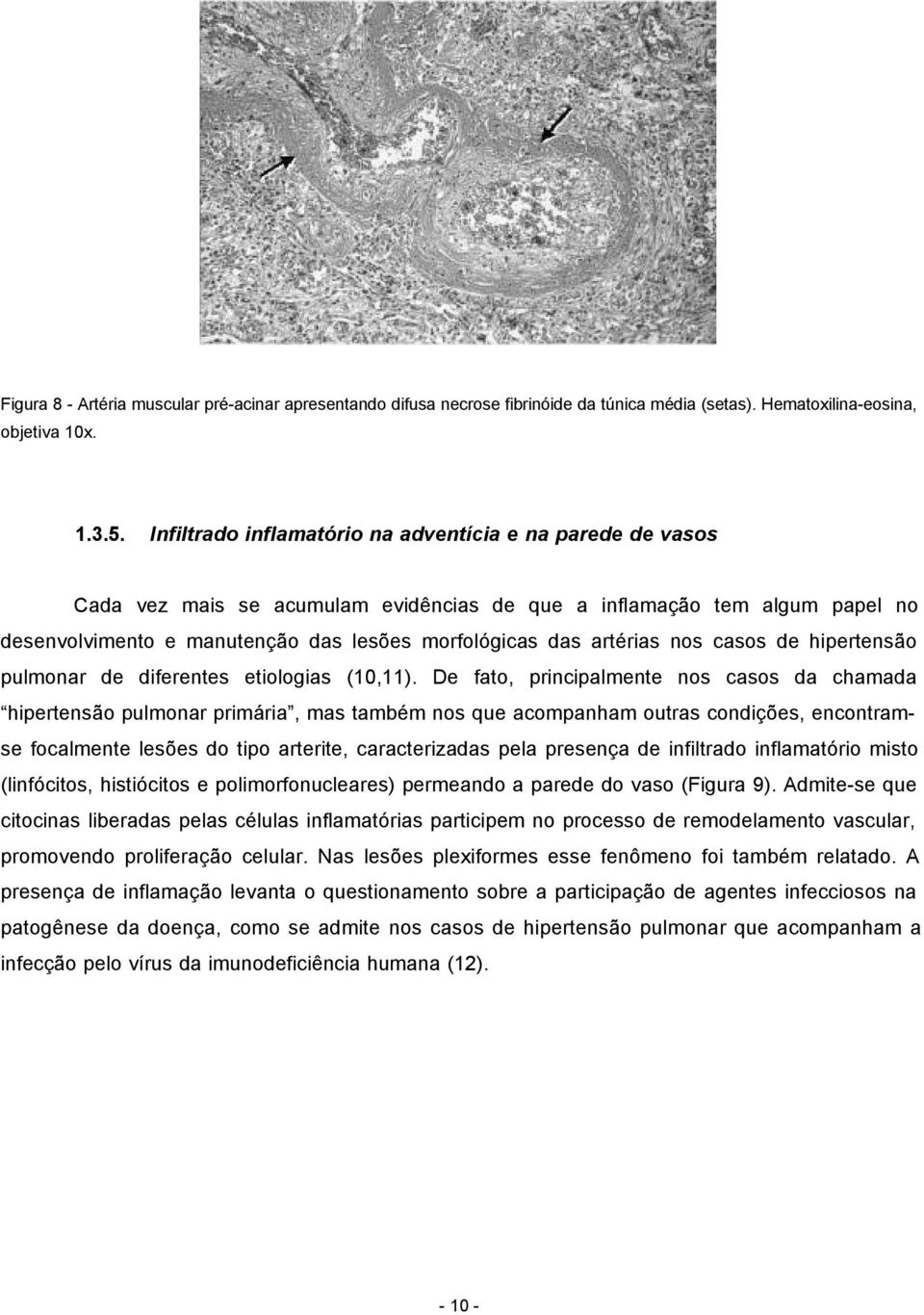 artérias nos casos de hipertensão pulmonar de diferentes etiologias (10,11).