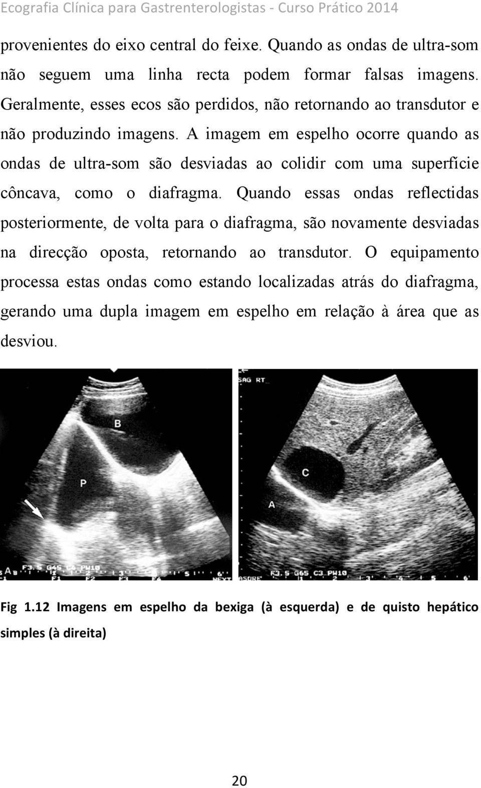 A imagem em espelho ocorre quando as ondas de ultra-som são desviadas ao colidir com uma superfície côncava, como o diafragma.