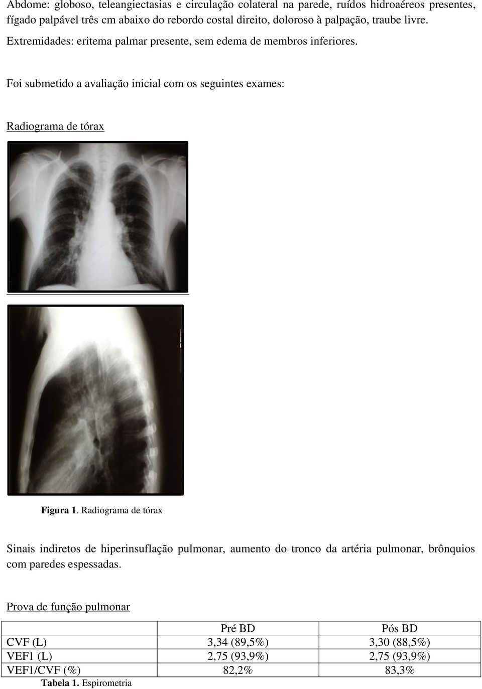 Foi submetido a avaliação inicial com os seguintes exames: Radiograma de tórax Figura 1.