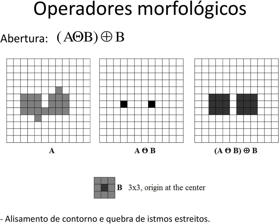 Alisamento de contorno e