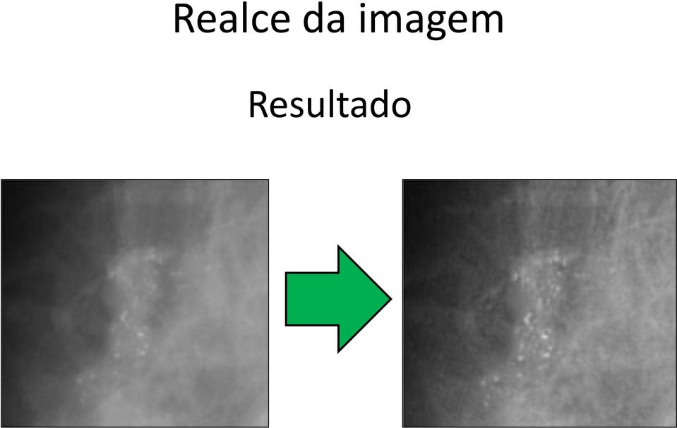 Resultado