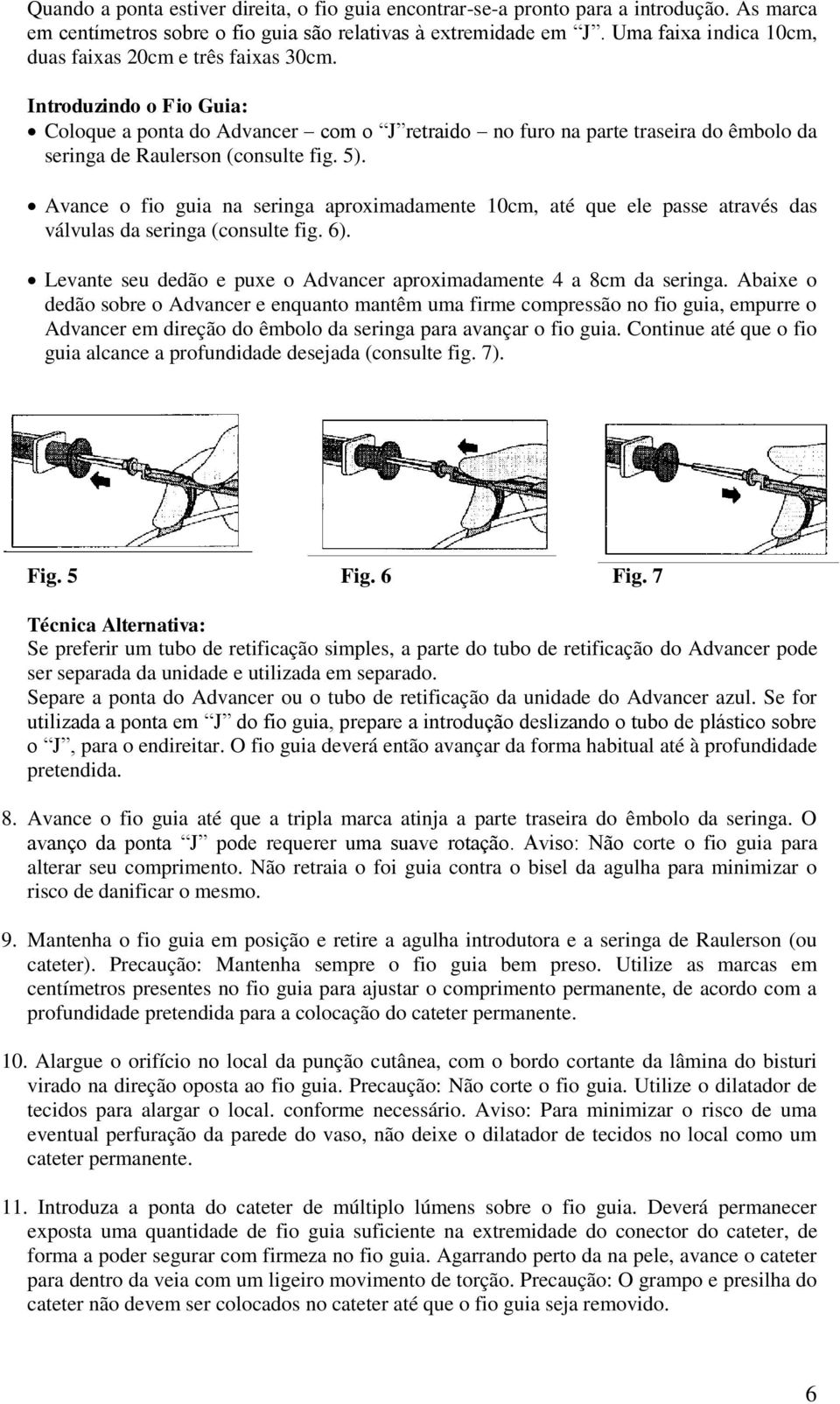 Introduzindo o Fio Guia: Coloque a ponta do Advancer com o J retraido no furo na parte traseira do êmbolo da seringa de Raulerson (consulte fig. 5).