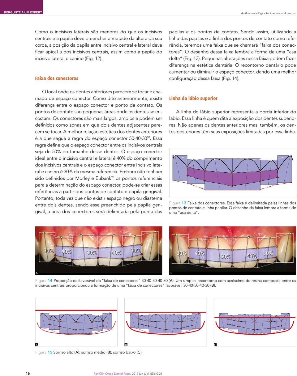 Faixa dos conectores O local onde os dentes anteriores parecem se tocar é chamado de espaço conector. Como dito anteriormente, existe diferença entre o espaço conector e ponto de contato.