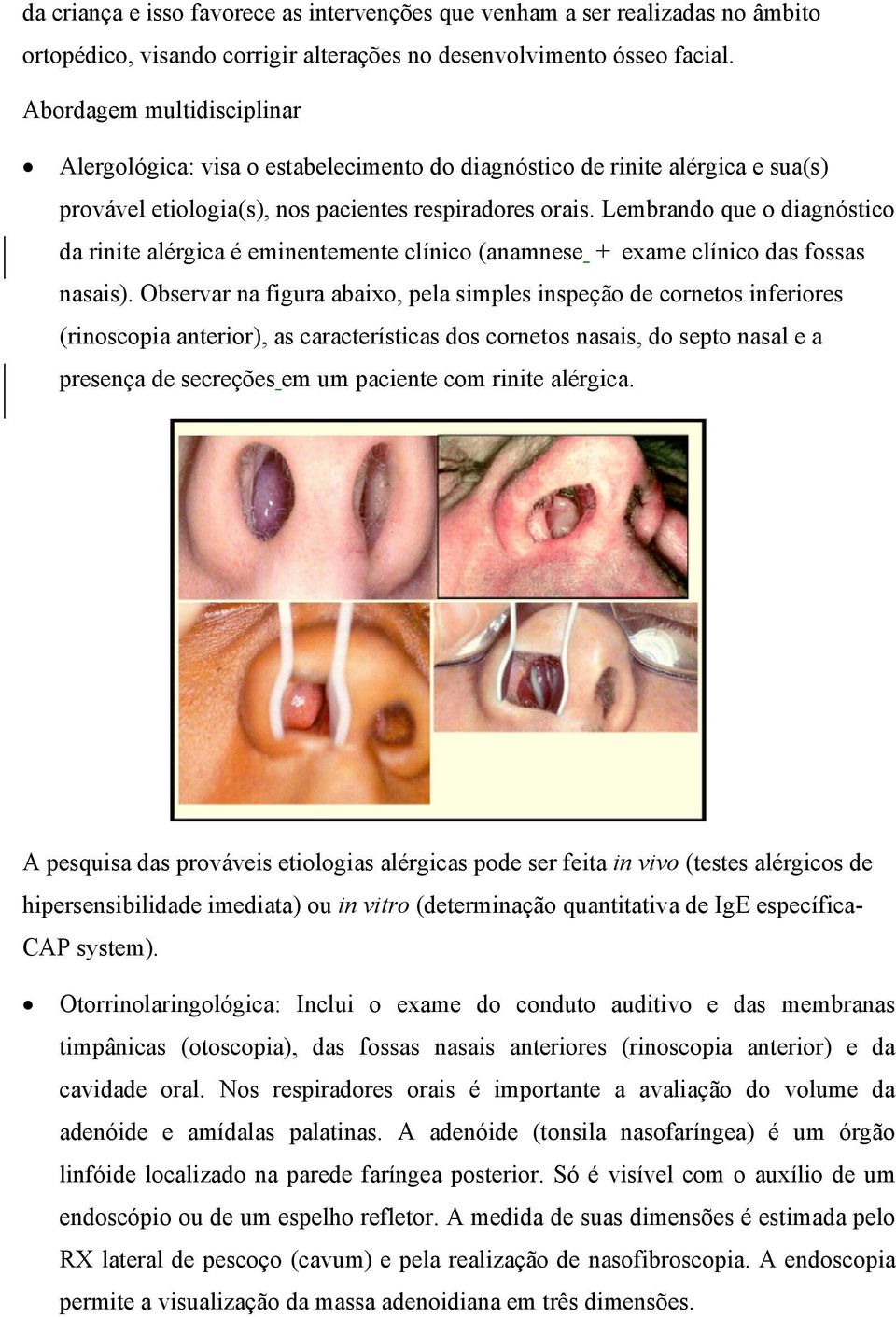 Lembrando que o diagnóstico da rinite alérgica é eminentemente clínico (anamnese + exame clínico das fossas nasais).