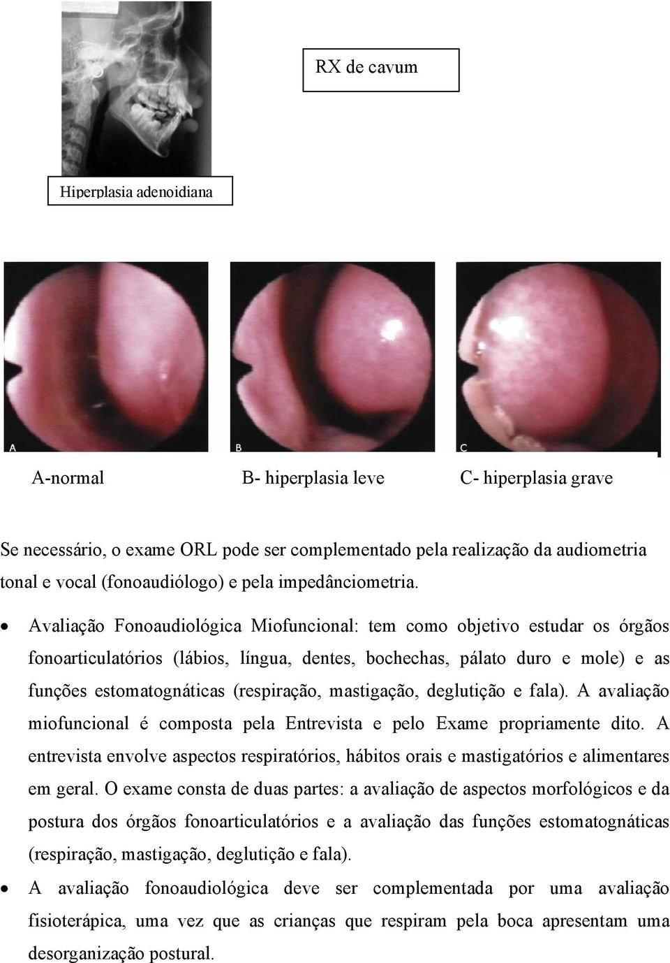 Avaliação Fonoaudiológica Miofuncional: tem como objetivo estudar os órgãos fonoarticulatórios (lábios, língua, dentes, bochechas, pálato duro e mole) e as funções estomatognáticas (respiração,