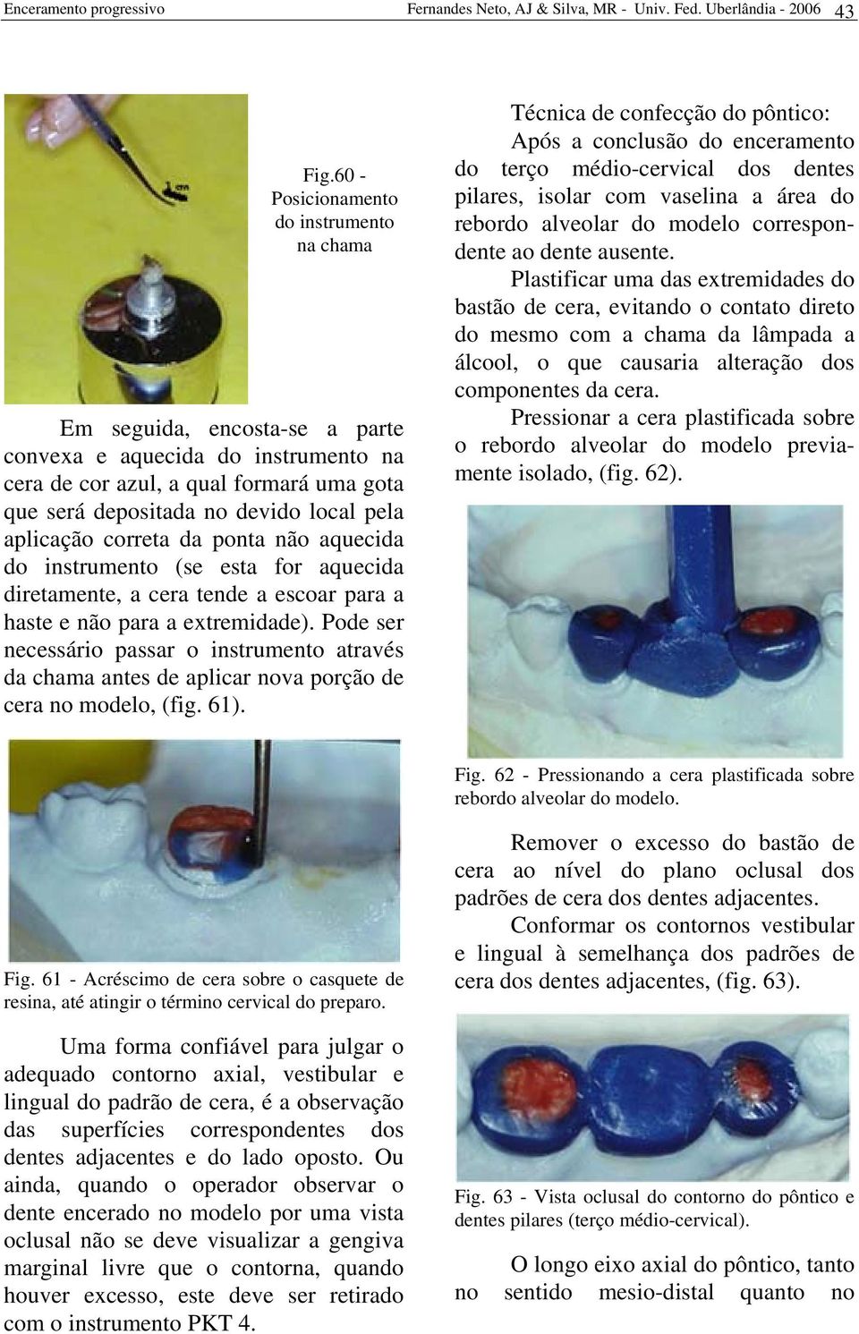 aplicação correta da ponta não aquecida do instrumento (se esta for aquecida diretamente, a cera tende a escoar para a haste e não para a extremidade).