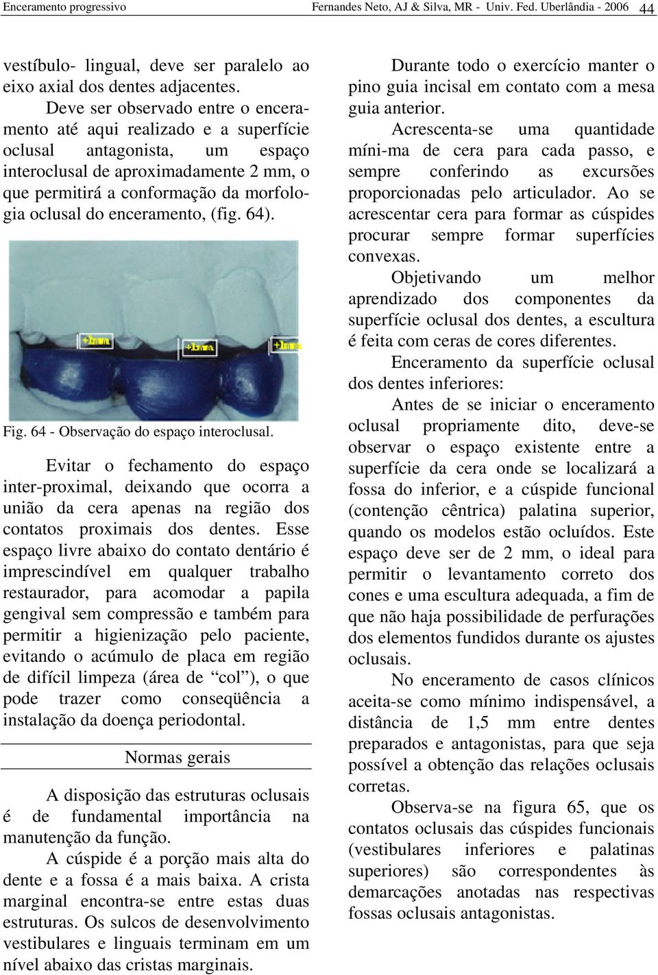 enceramento, (fig. 64). Fig. 64 - Observação do espaço interoclusal.