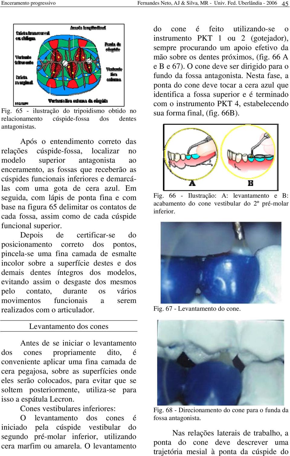 cera azul. Em seguida, com lápis de ponta fina e com base na figura 65 delimitar os contatos de cada fossa, assim como de cada cúspide funcional superior.