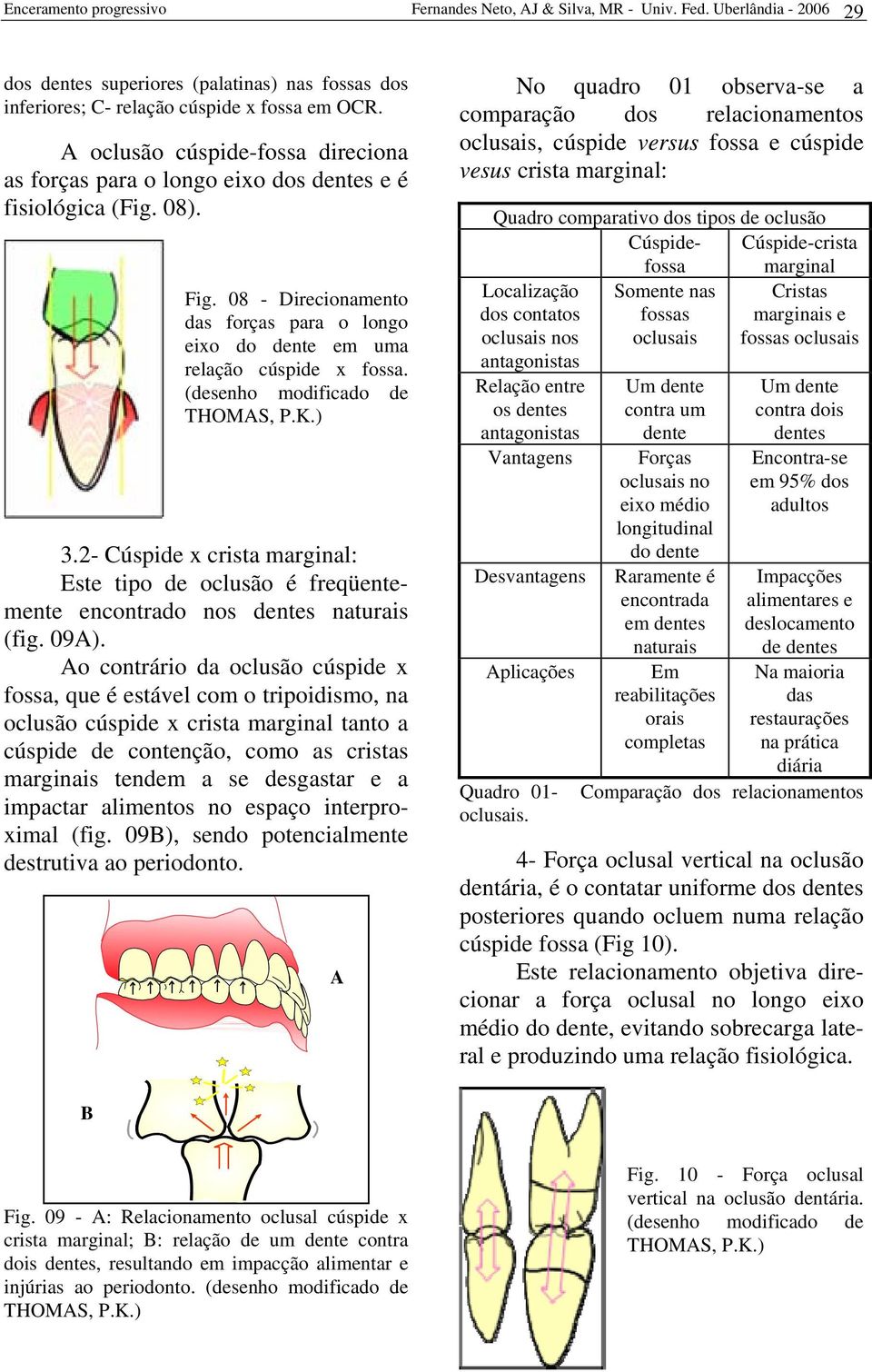 (desenho modificado de THOMAS, P.K.) 3.2- Cúspide x crista marginal: Este tipo de oclusão é freqüentemente encontrado nos dentes naturais (fig. 09A).