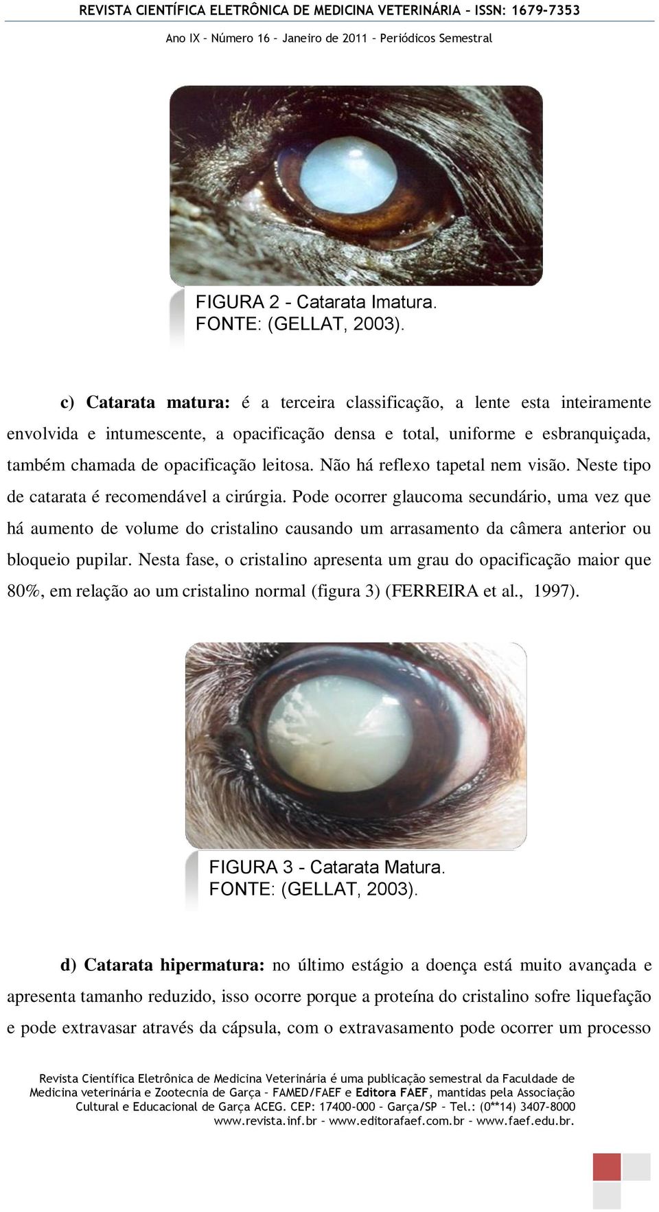 Não há reflexo tapetal nem visão. Neste tipo de catarata é recomendável a cirúrgia.