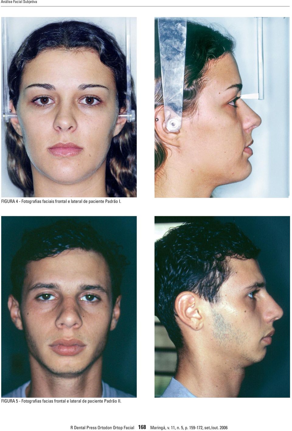 FIGURA 5 - Fotografias facias frontal e lateral de paciente