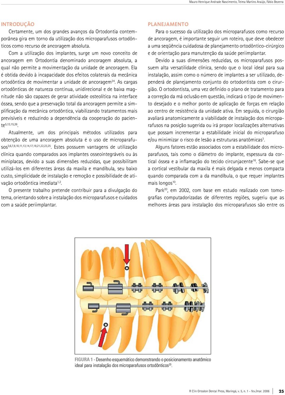 Com a utilização dos implantes, surge um novo conceito de ancoragem em Ortodontia denominado ancoragem absoluta, a qual não permite a movimentação da unidade de ancoragem.