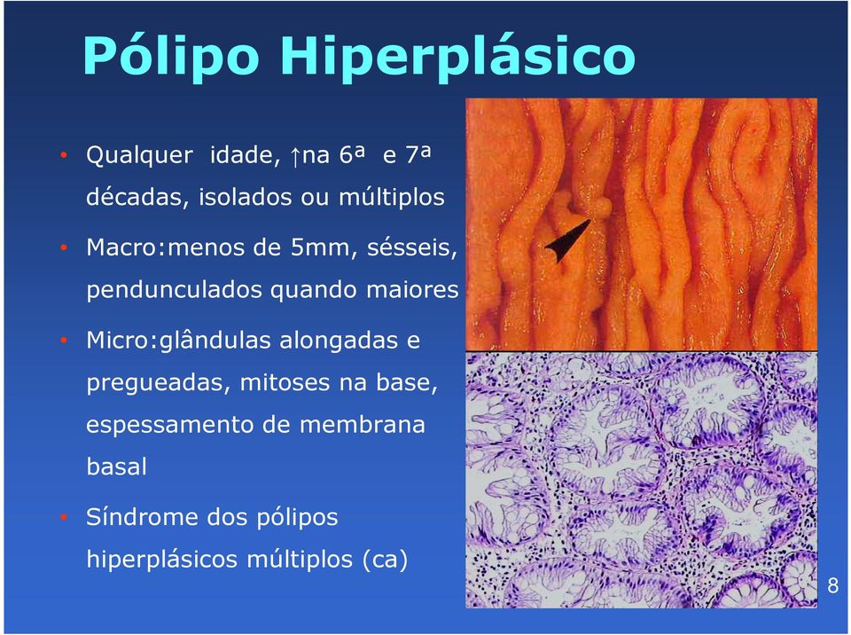 Micro:glândulas alongadas e pregueadas, mitoses na base,