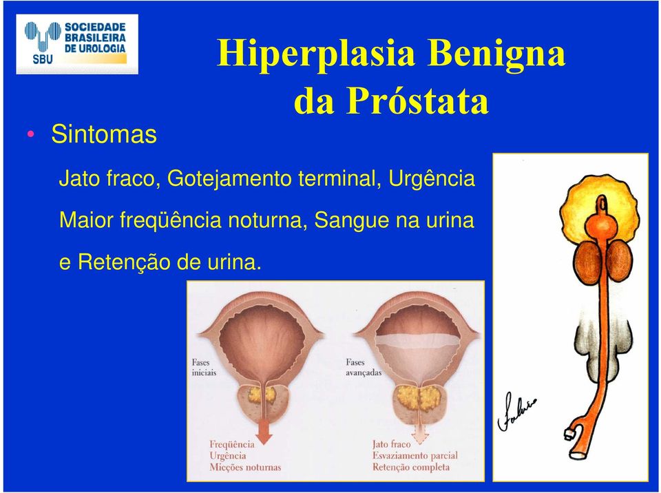 terminal, Urgência Maior freqüência