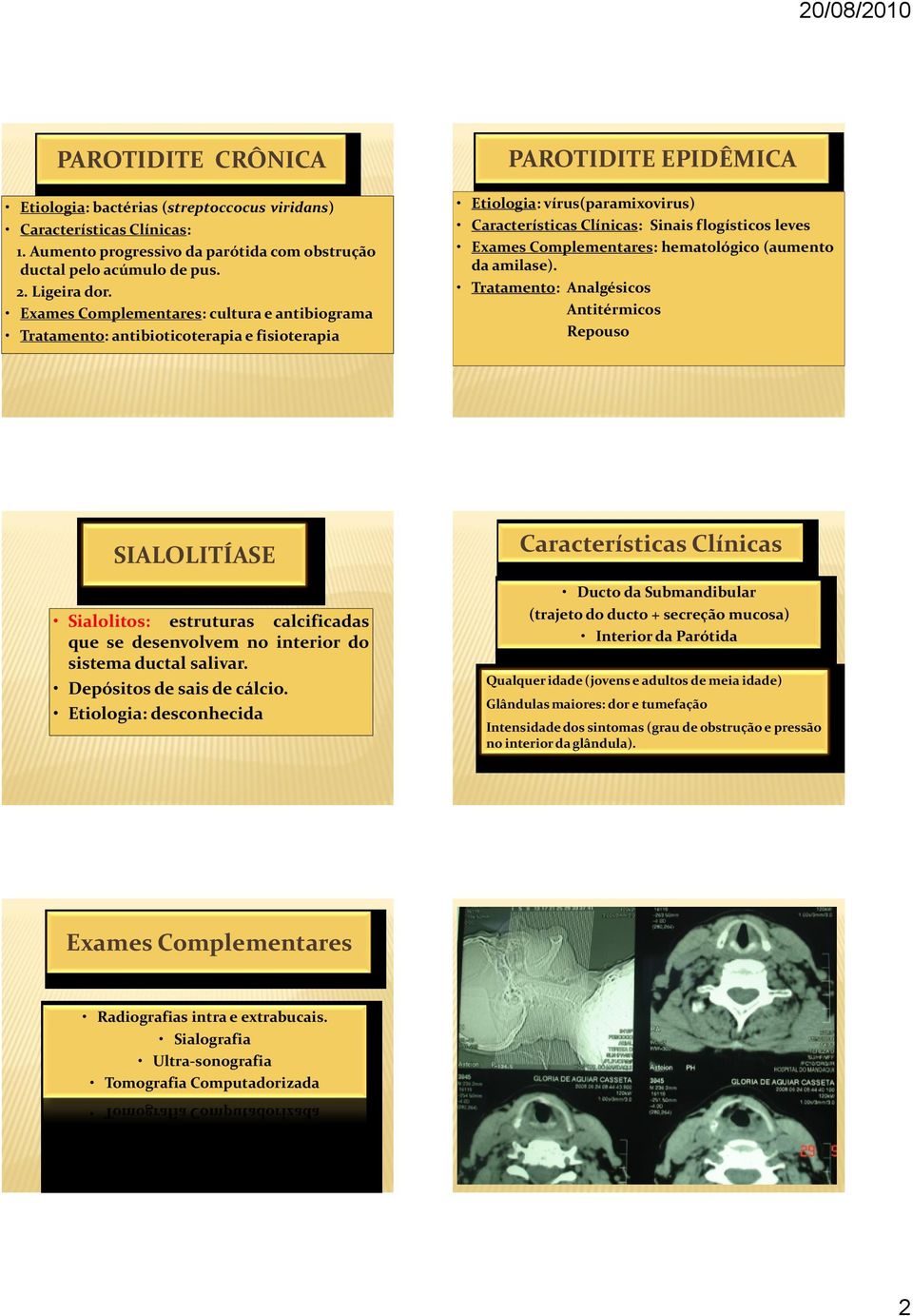 hematológico (aumento da amilase). Tratamento: Analgésicos Antitérmicos Repouso SIALOLITÍASE Sialolitos: estruturas calcificadas que se desenvolvem no interior do sistema ductal salivar.