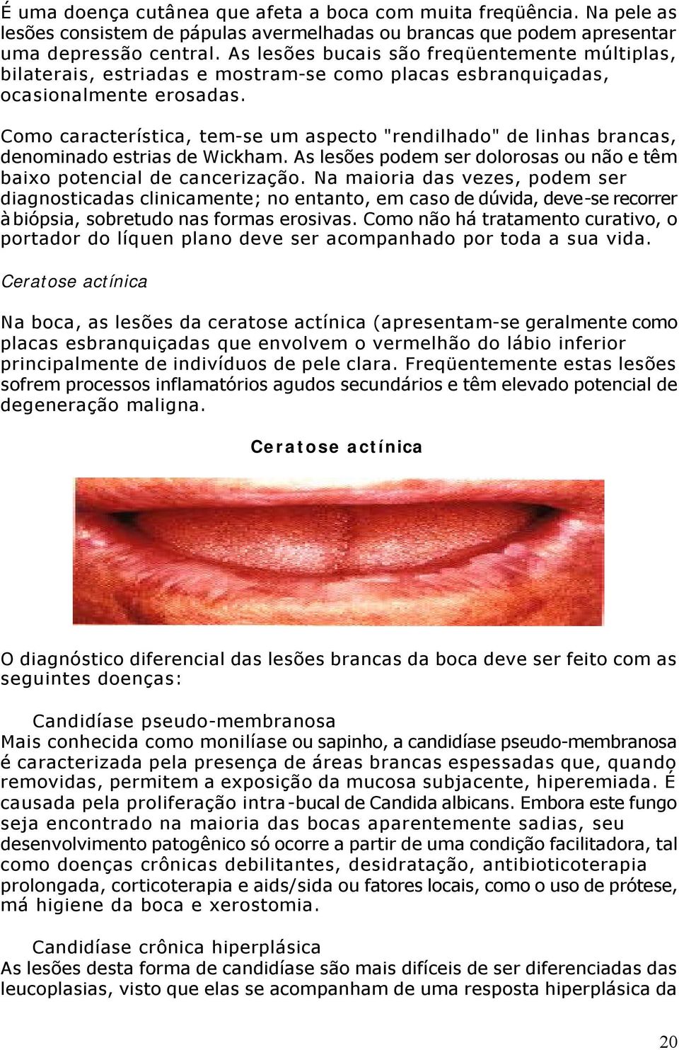 Como característica, tem-se um aspecto "rendilhado" de linhas brancas, denominado estrias de Wickham. As lesões podem ser dolorosas ou não e têm baixo potencial de cancerização.