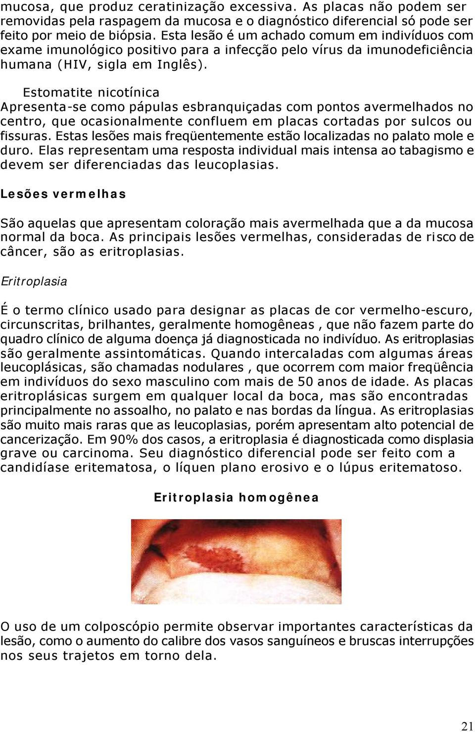 Estomatite nicotínica Apresenta-se como pápulas esbranquiçadas com pontos avermelhados no centro, que ocasionalmente confluem em placas cortadas por sulcos ou fissuras.