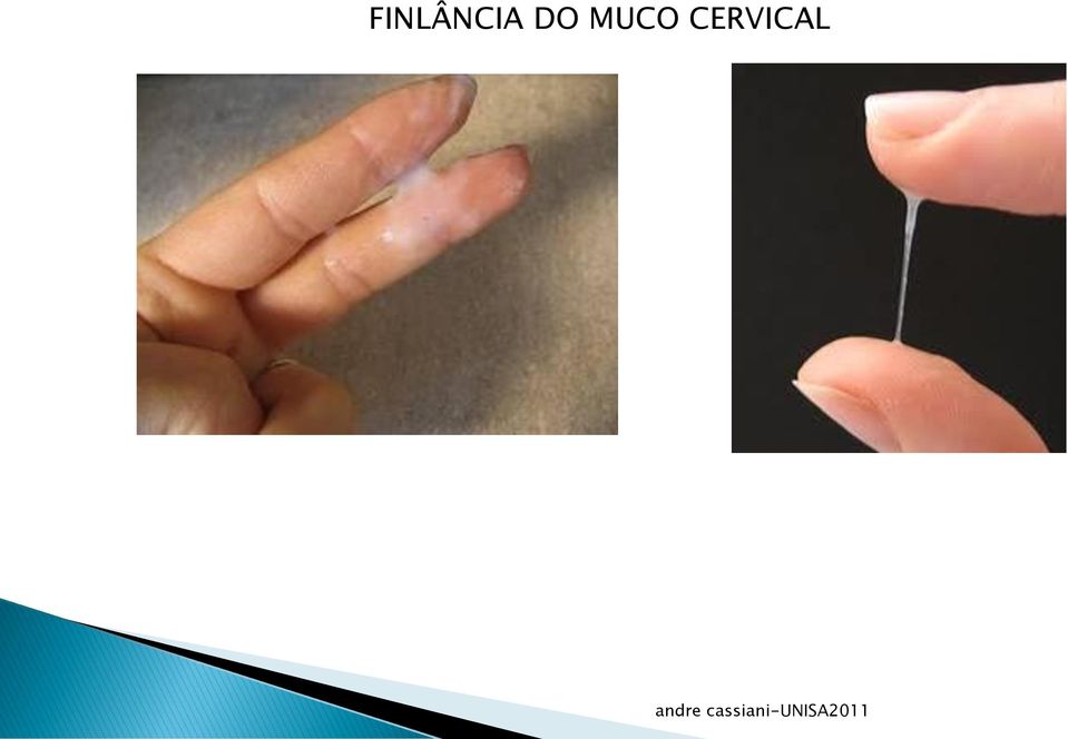 CERVICAL