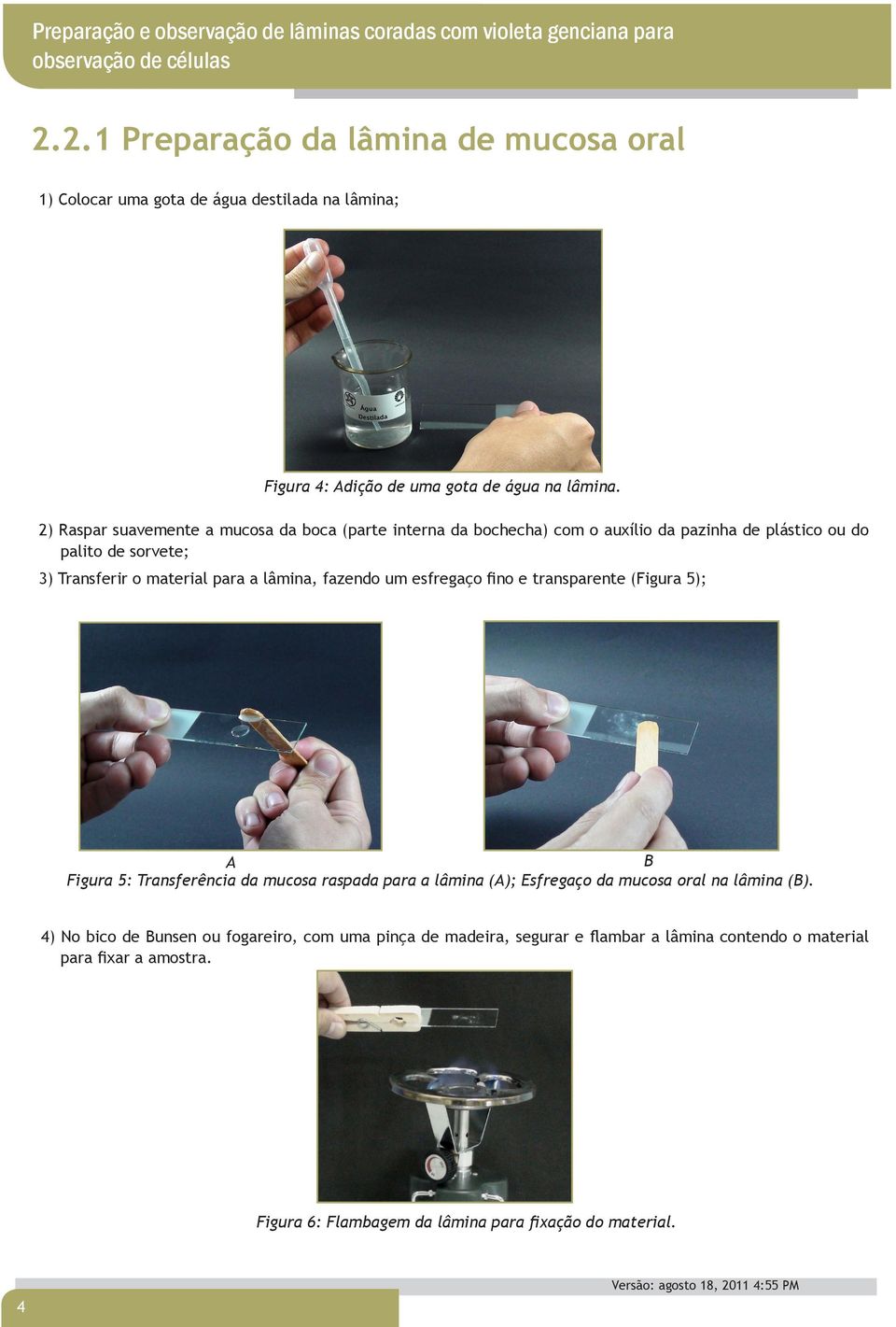 2) Raspar suavemente a mucosa da boca (parte interna da bochecha) com o auxílio da pazinha de plástico ou do palito de sorvete; 3) Transferir o material para a lâmina, fazendo um