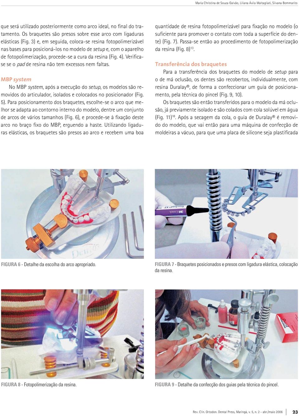 3) e, em seguida, coloca-se resina fotopolimerizável nas bases para posicioná-los no modelo de setup e, com o aparelho de fotopolimerização, procede-se a cura da resina (Fig. 4).