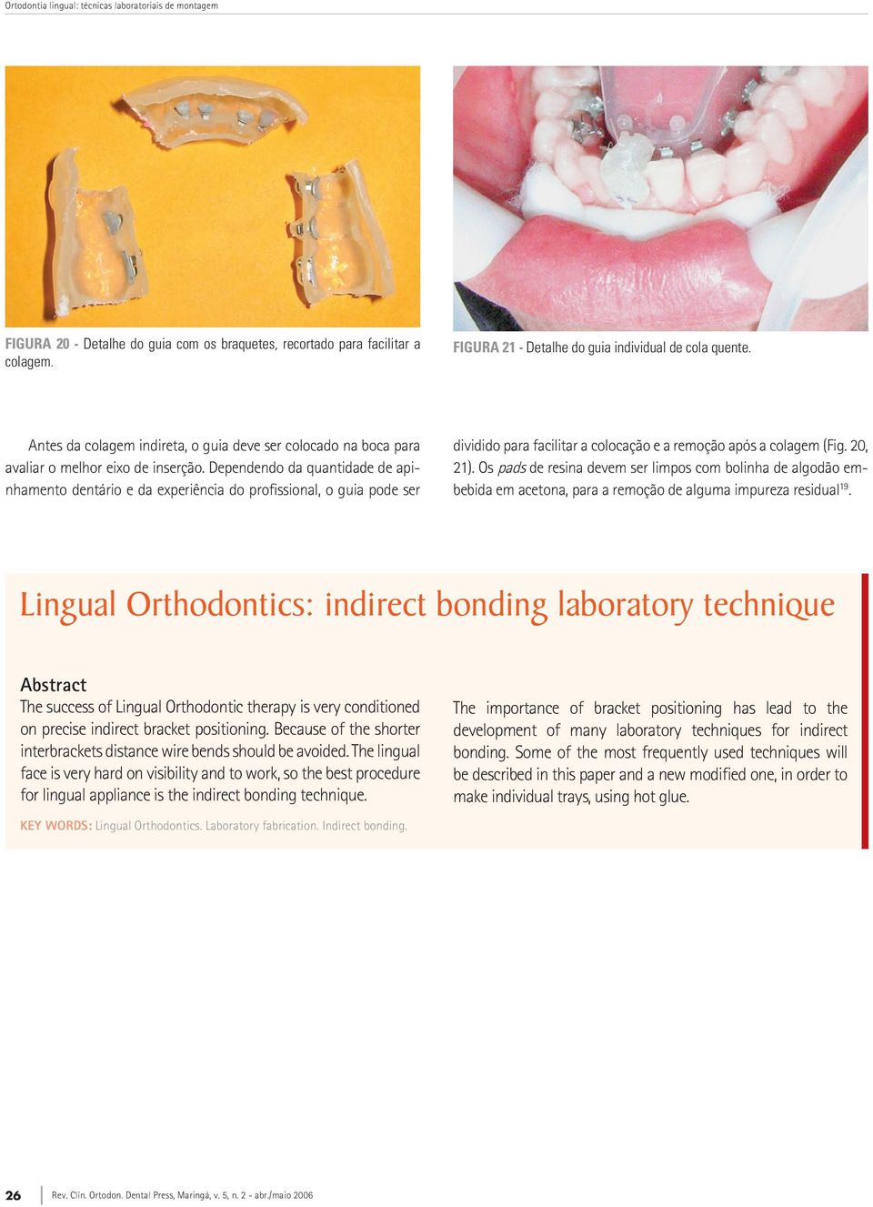 Dependendo da quantidade de apinhamento dentário e da experiência do profissional, o guia pode ser dividido para facilitar a colocação e a remoção após a colagem (Fig. 20, 21).