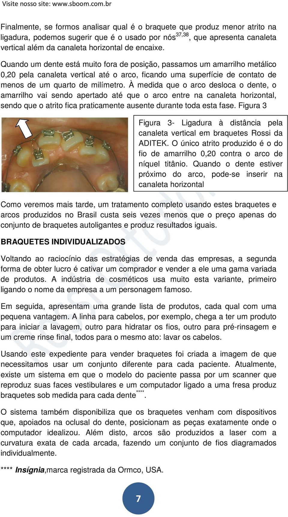 À medida que o arco desloca o dente, o amarrilho vai sendo apertado até que o arco entre na canaleta horizontal, sendo que o atrito fica praticamente ausente durante toda esta fase.