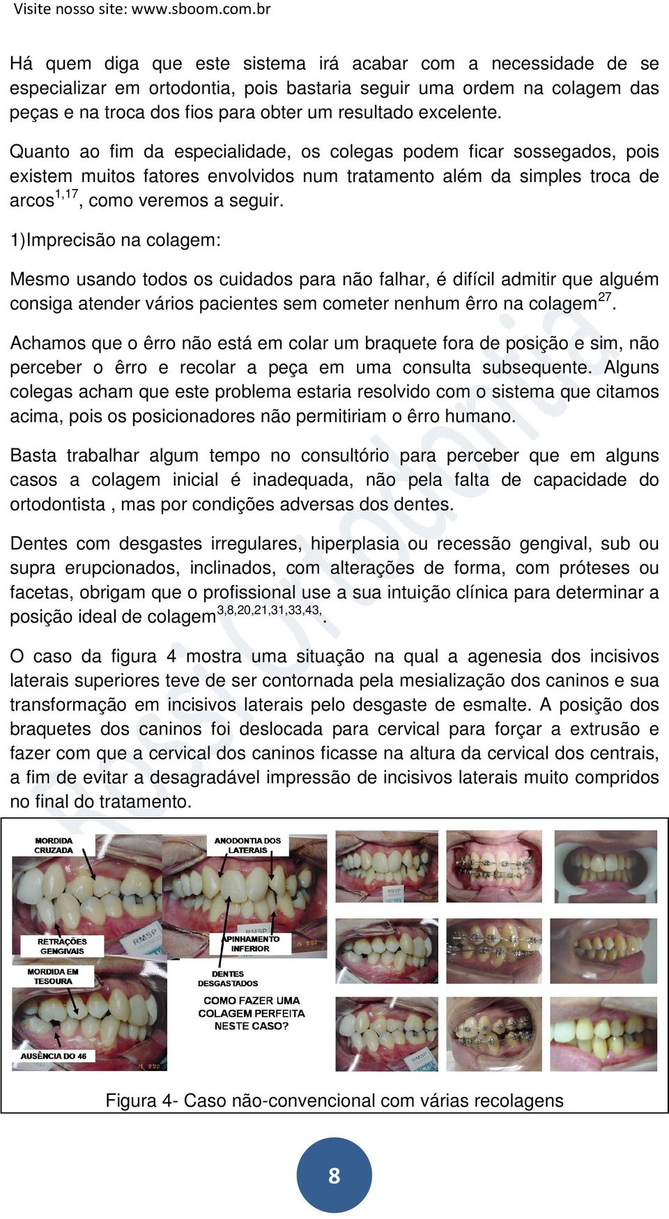 1)Imprecisão na colagem: Mesmo usando todos os cuidados para não falhar, é difícil admitir que alguém consiga atender vários pacientes sem cometer nenhum êrro na colagem 27.