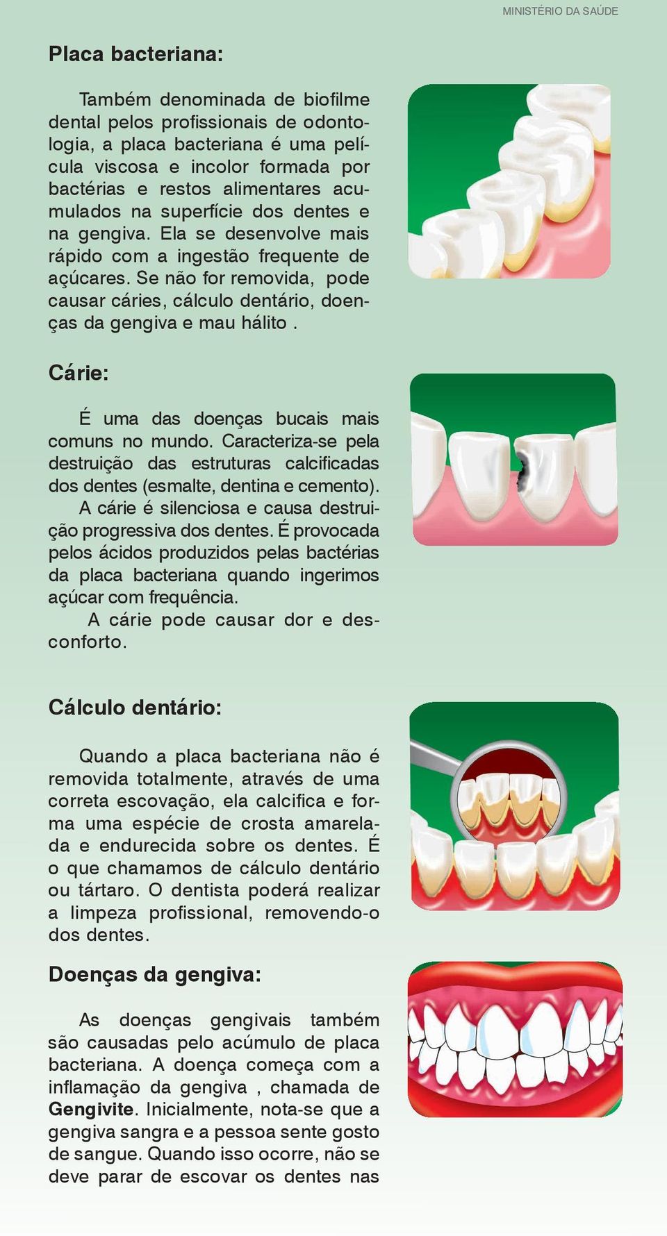 Cárie: É uma das doenças bucais mais comuns no mundo. Caracteriza-se pela destruição das estruturas calcifi cadas dos dentes (esmalte, dentina e cemento).