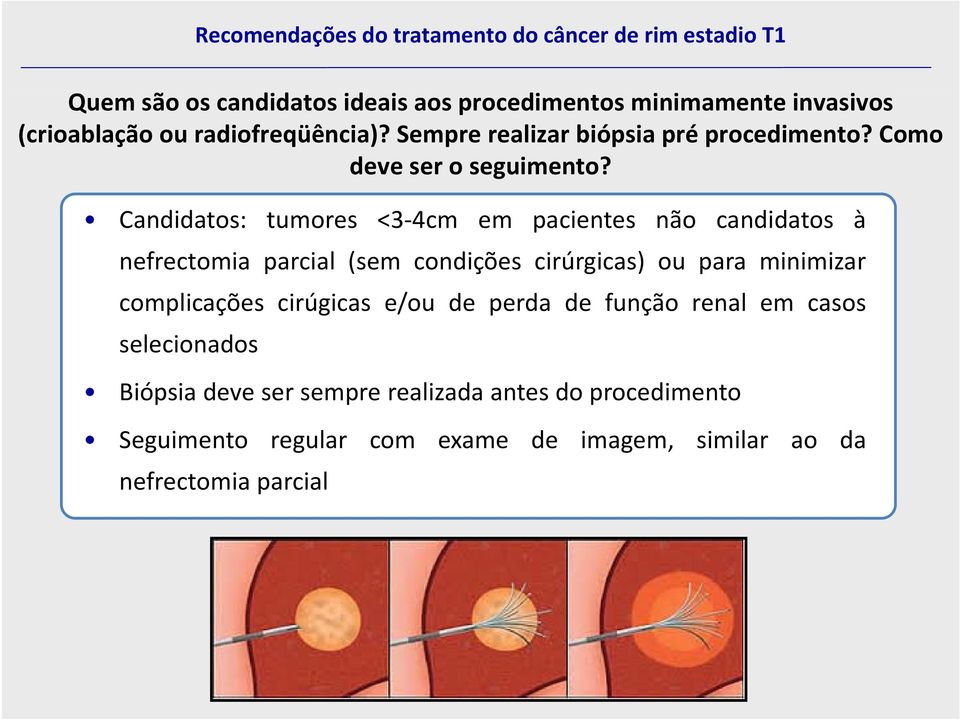 Candidatos: tumores <3 4cm em pacientes não candidatos à nefrectomia parcial (sem condições cirúrgicas) ou para minimizar