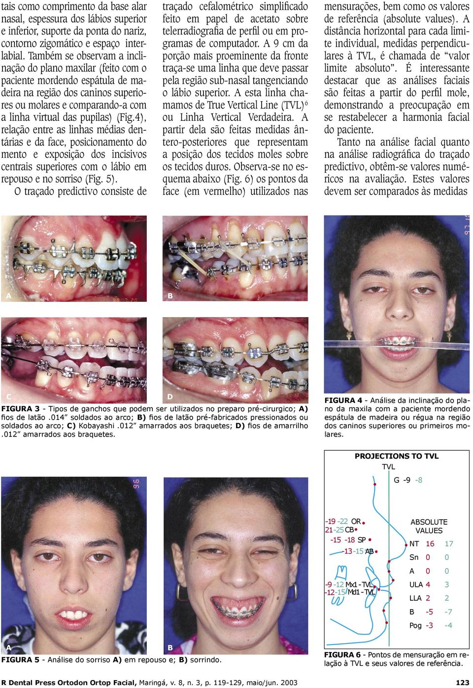 4), relação entre as linhas médias dentárias e da face, posicionamento do mento e exposição dos incisivos centrais superiores com o lábio em repouso e no sorriso (Fig. 5).