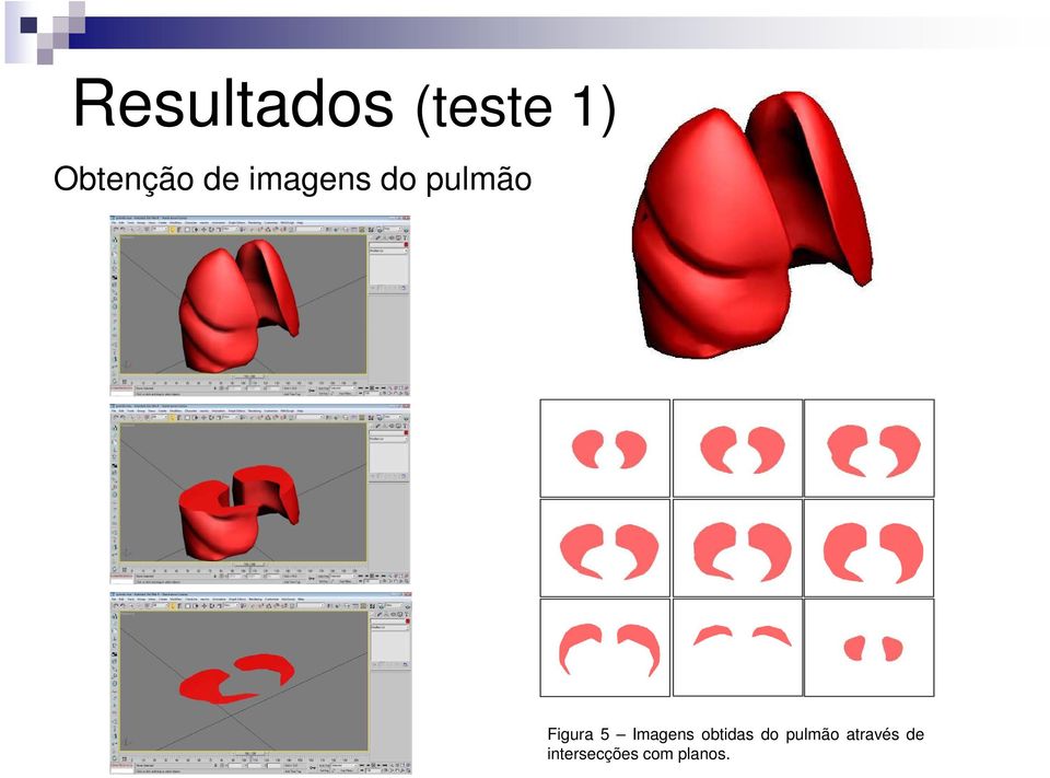 Imagens obtidas do pulmão