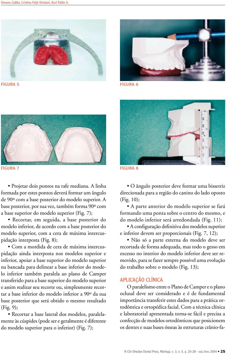 7); Recortar, em seguida, a base posterior do modelo inferior, de acordo com a base posterior do modelo superior, com a cera de máxima intercuspidação interposta (Fig.