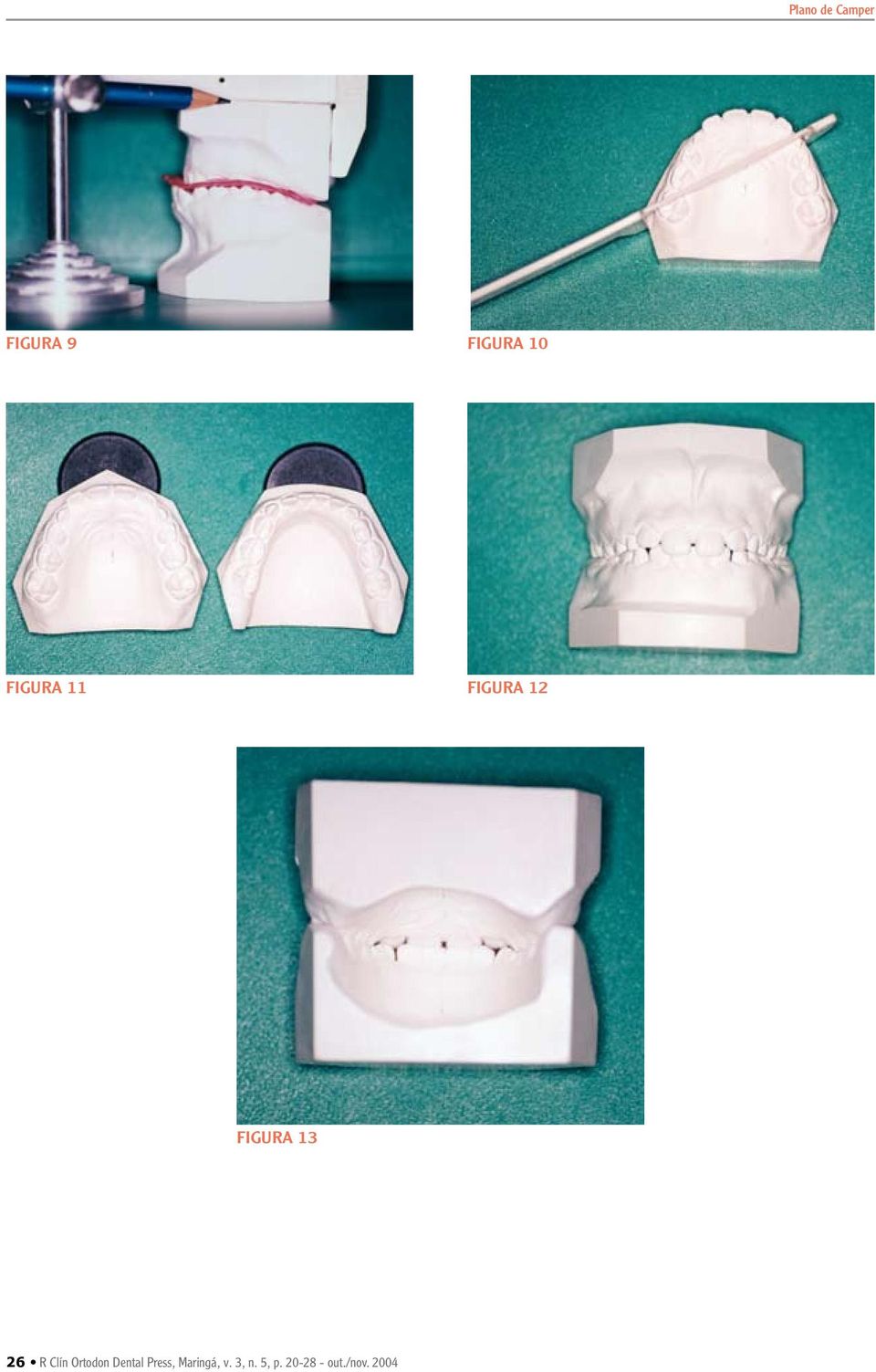 Clín Ortodon Dental Press, Maringá,