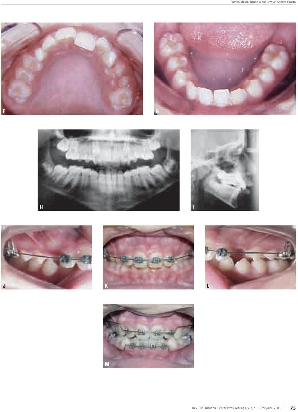 Clín. Ortodon.