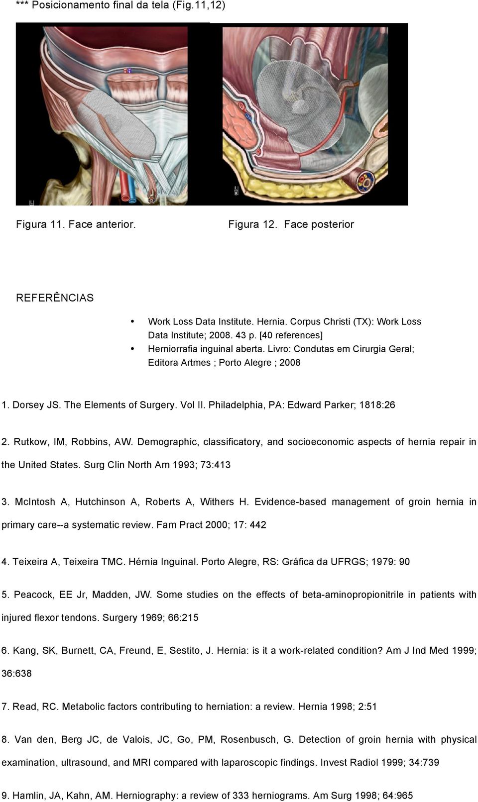 Philadelphia, PA: Edward Parker; 1818:26 2. Rutkow, IM, Robbins, AW. Demographic, classificatory, and socioeconomic aspects of hernia repair in the United States. Surg Clin North Am 1993; 73:413 3.