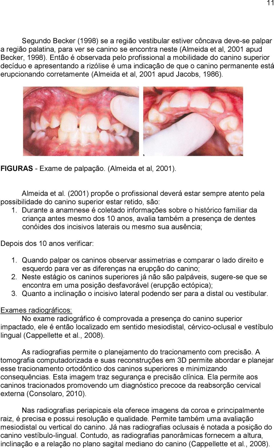 apud Jacobs, 1986). FIGURAS - Exame de palpação. (Almeida et al, 2001). Almeida et al.