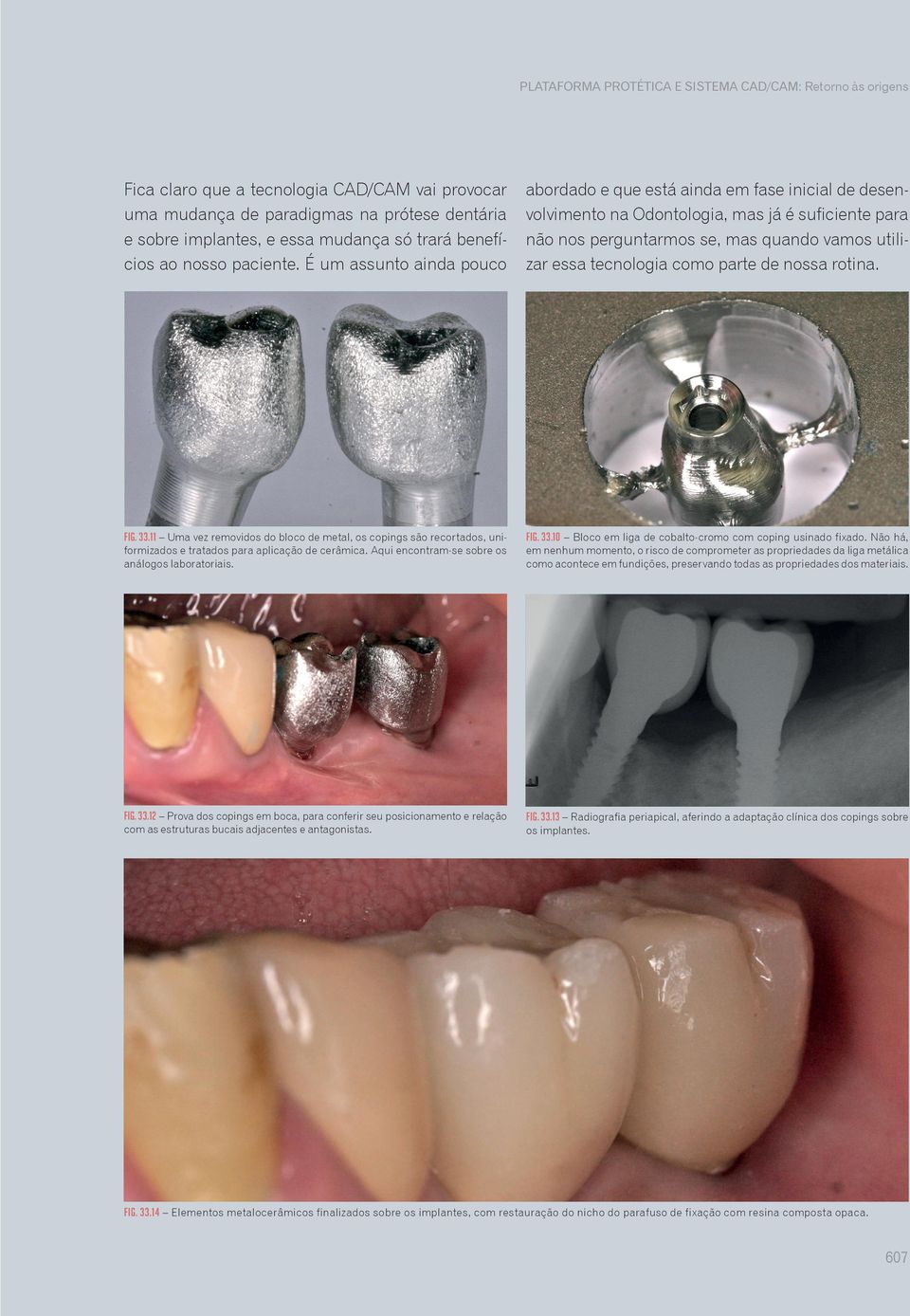 É um assunto ainda pouco abordado e que está ainda em fase inicial de desenvolvimento na Odontologia, mas já é suficiente para não nos perguntarmos se, mas quando vamos utilizar essa tecnologia como