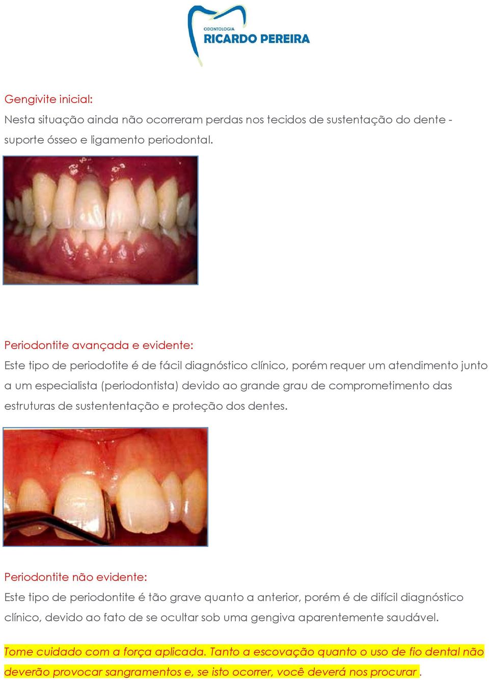 comprometimento das estruturas de sustententação e proteção dos dentes.