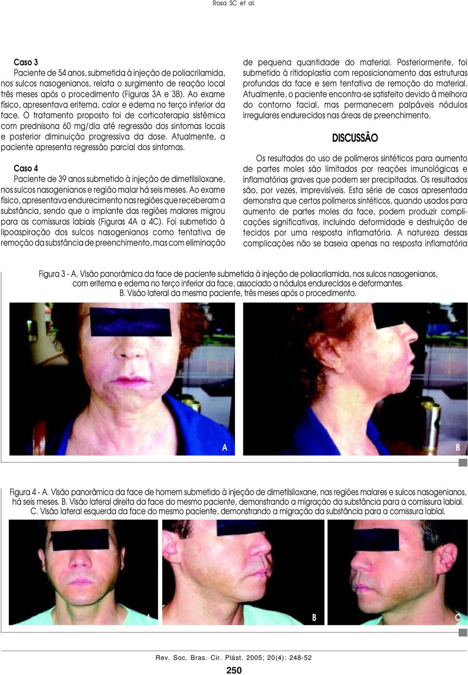 O tratamento proposto foi de corticoterapia sistêmica com prednisona 60 mg/dia até regressão dos sintomas locais e posterior diminuição progressiva da dose.