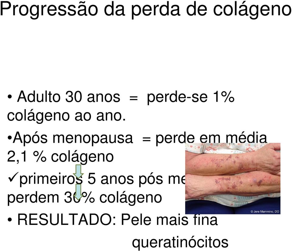 Após menopausa = perde em média 2,1 % colágeno