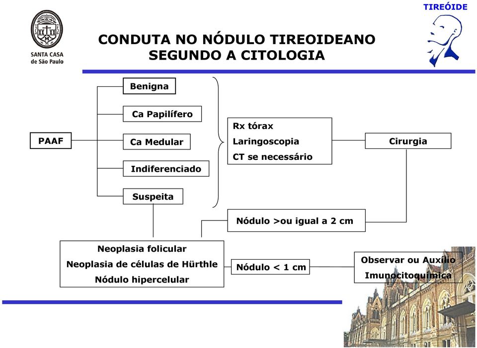 Suspeita Nódulo >ou igual a 2 cm Neoplasia folicular Neoplasia de células de