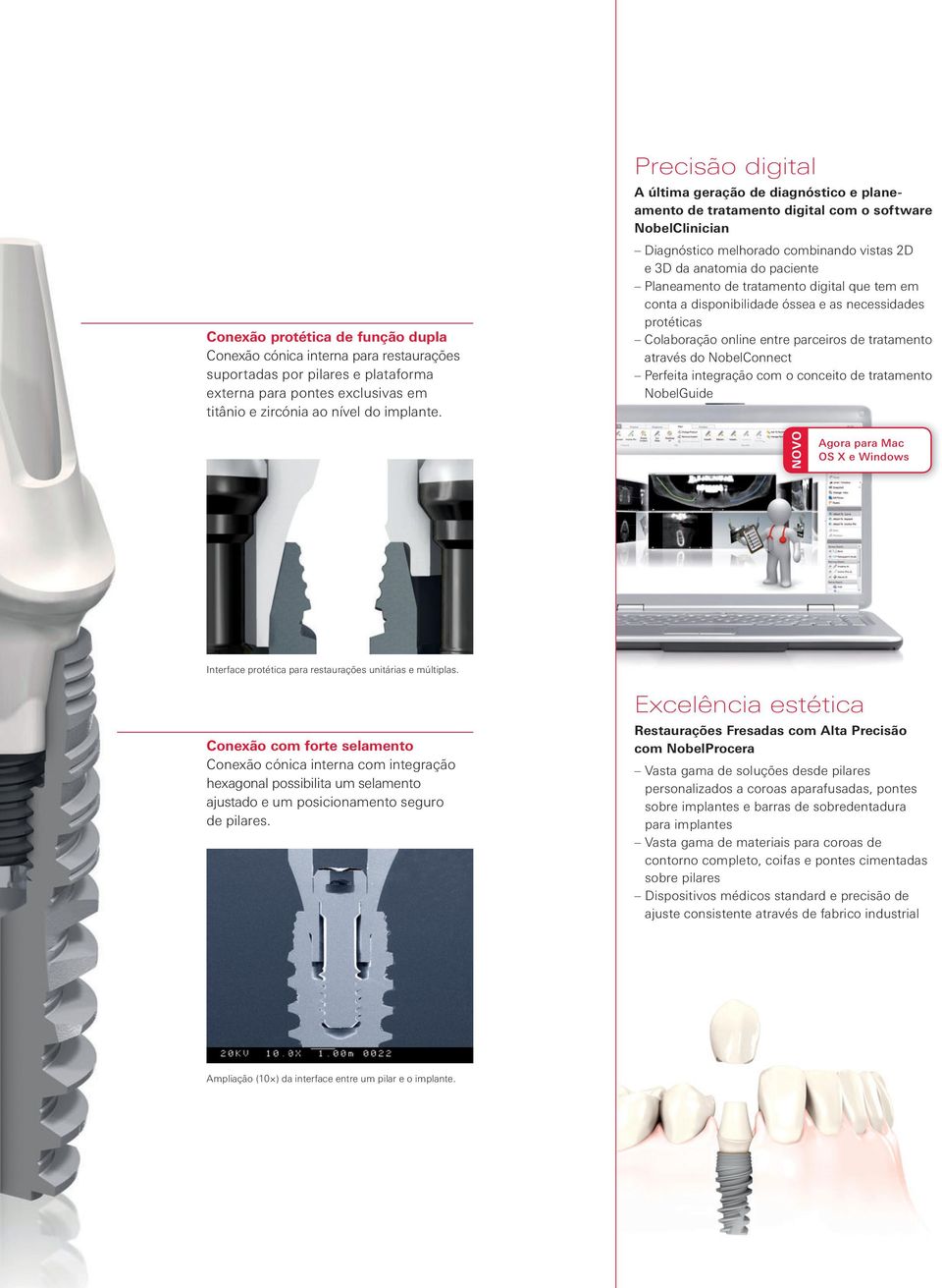 de tratamento digital que tem em conta a disponibilidade óssea e as necessidades protéticas Colaboração online entre parceiros de tratamento através do NobelConnect Perfeita integração com o conceito