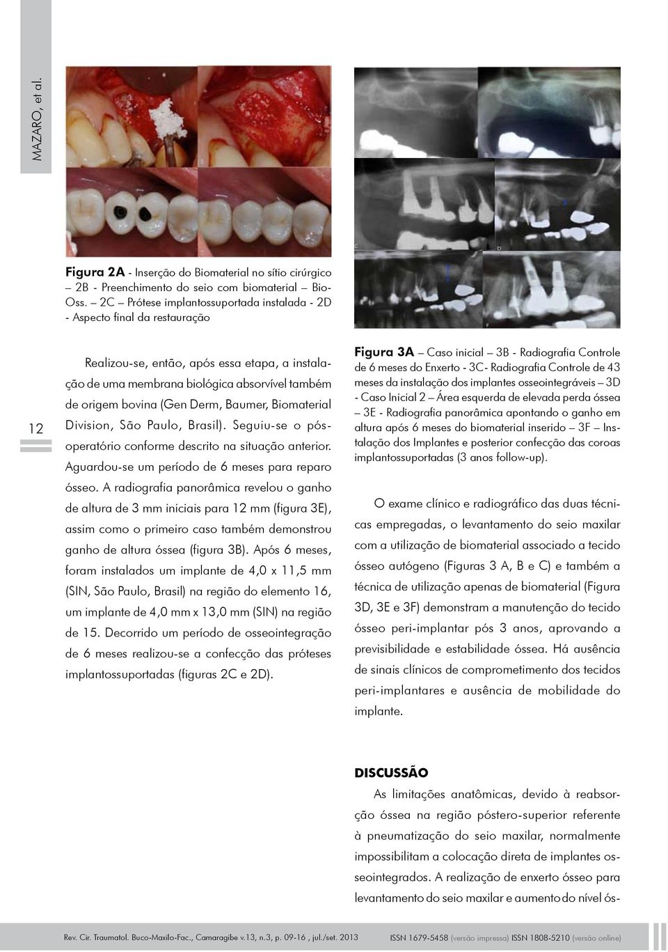 Derm, Baumer, Biomaterial Division, São Paulo, Brasil). Seguiu-se o pósoperatório conforme descrito na situação anterior. Aguardou-se um período de 6 meses para reparo ósseo.