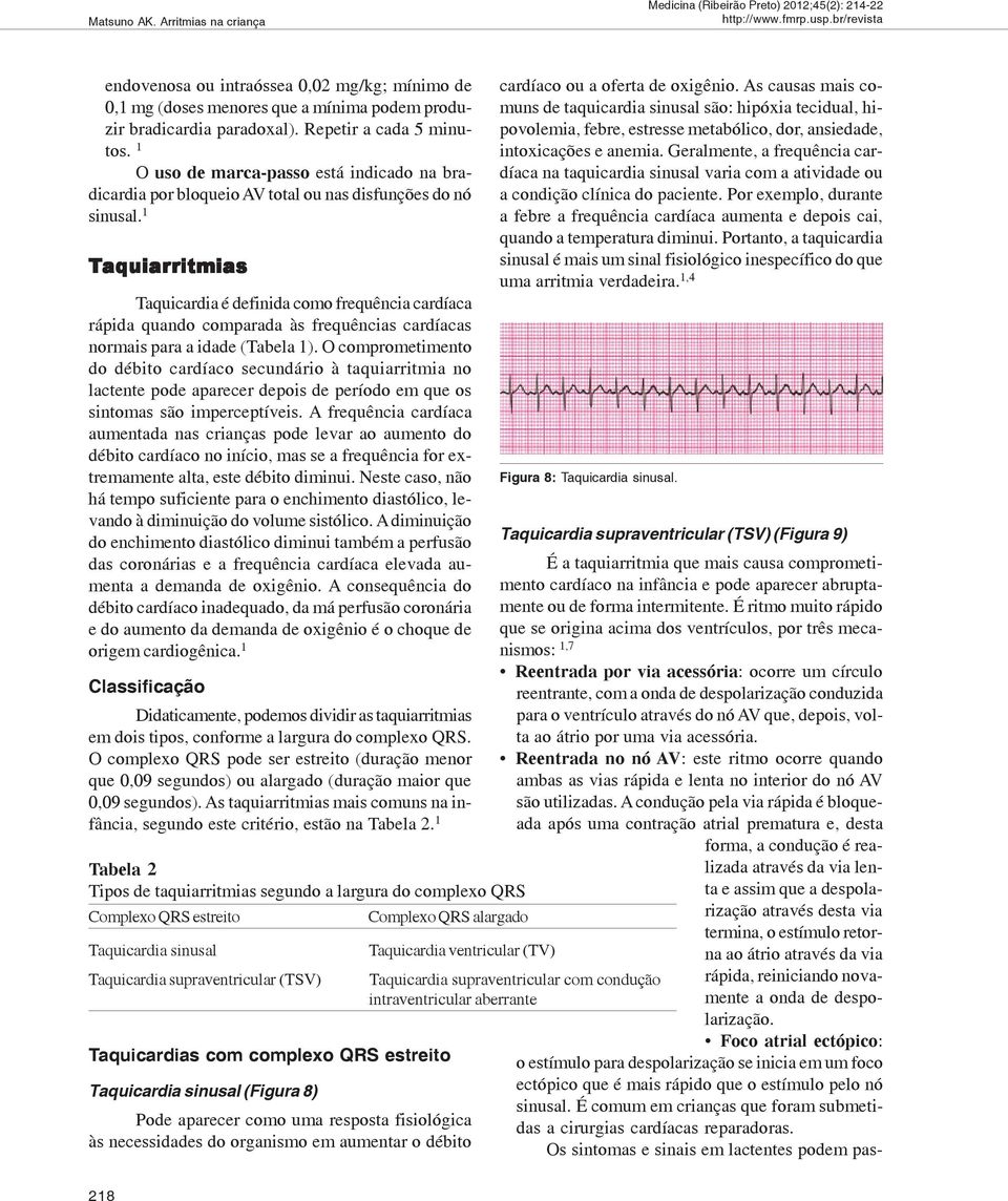 1 Taquiar aquiarritmias ritmias Taquicardia é definida como frequência cardíaca rápida quando comparada às frequências cardíacas normais para a idade (Tabela 1).